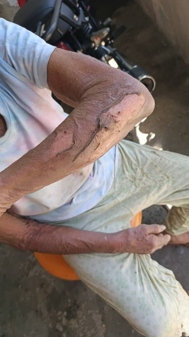 Adulto mayor sufrió quemaduras durante incendio residencial en Valencia