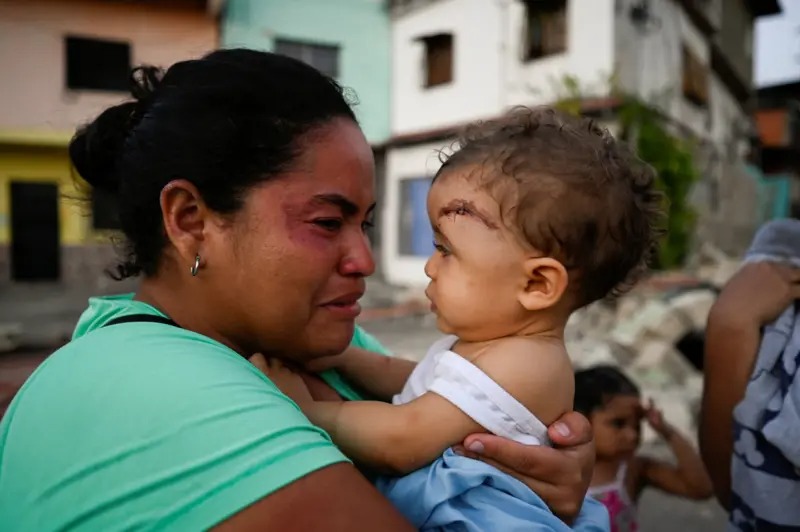 Hay 3,9 millones de niños en las zonas afectadas, dice Unicef