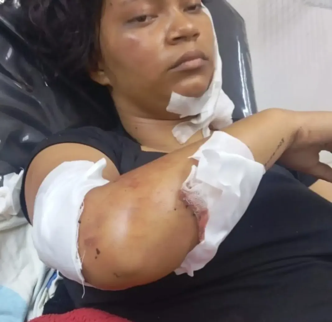 Expolicía apuñaló 16 veces y luego arrolló a su expareja en Naguanagua