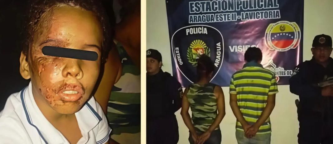 Detienen a pareja por lesionar en el rostro a niño de 10 años con comida hirviendo