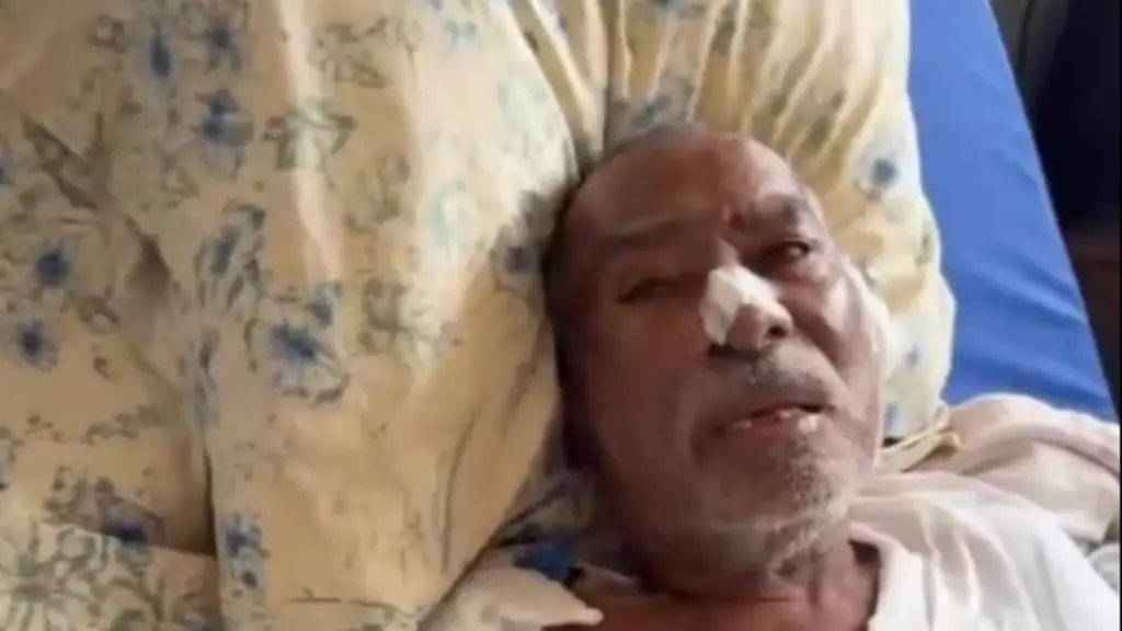 Adulto mayor sufre graves quemaduras tras ataque por extorsión