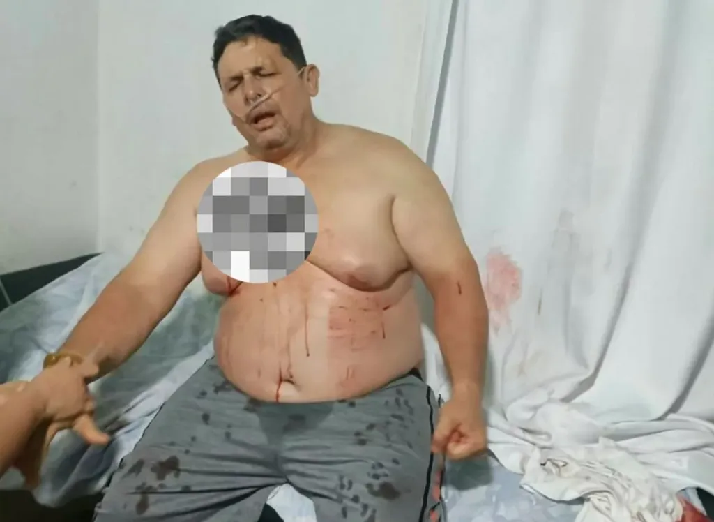 Atacan a balazos a productor ganadero en Falcón