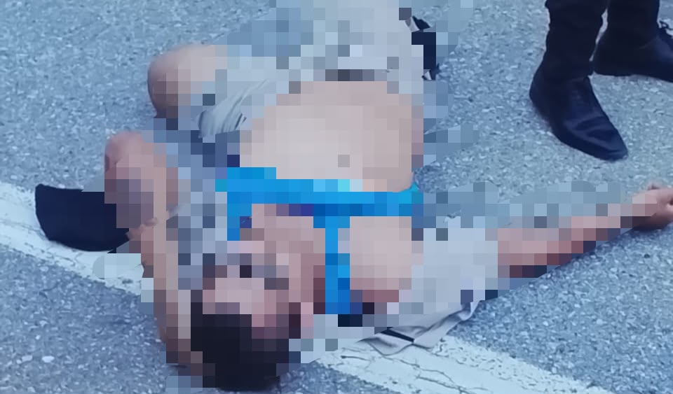 Hombre resultó herido por falla mecánica de moto en Puerto Cabello